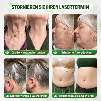 𝑯𝒆𝒂𝒍𝒓𝒊𝒛𝒆® 🧬𝑷𝑫𝑹𝑵 𝑨𝒏𝒕𝒊-𝑨𝒈𝒊𝒏𝒈 & 𝑮𝒆𝒛𝒊𝒆𝒍𝒕𝒆𝒓 𝑯𝒂𝒖𝒕𝒆𝒓𝒏𝒆𝒖𝒆𝒓𝒖𝒏𝒈𝒔-𝑺𝒕𝒊𝒄𝒌 𝒈𝒆𝒈𝒆𝒏 𝑭𝒍𝒆𝒄𝒌𝒆𝒏（𝑯𝒊𝒍𝒇𝒕, 𝑭𝒂𝒍𝒕𝒆𝒏 𝒛𝒖 𝒈𝒍ä𝒕𝒕𝒆𝒏, 𝒖𝒏𝒕𝒆𝒓𝒔𝒕ü𝒕𝒛𝒕 𝒆𝒊𝒏 𝒔𝒕𝒓𝒂𝒇𝒇𝒆𝒓 𝒘𝒊𝒓𝒌𝒆𝒏𝒅𝒆𝒔 𝑯𝒂𝒖𝒕𝒃𝒊𝒍𝒅 𝒖𝒏𝒅 𝒗𝒆𝒓𝒃𝒆𝒔𝒔𝒆𝒓𝒕 𝒅𝒂𝒔 𝑬𝒓𝒔𝒄𝒉𝒆𝒊𝒏𝒖𝒏𝒈𝒔𝒃𝒊𝒍𝒅 𝒔𝒊𝒄𝒉𝒕𝒃𝒂𝒓𝒆𝒓 𝑭𝒍𝒆𝒄𝒌𝒆𝒏）