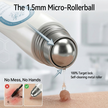 Healrize® 7-Tage Hautmal- & Flecken-Entferner 💫(Schmerzfrei, Narbenfrei mit Rollball-Applikator)💫