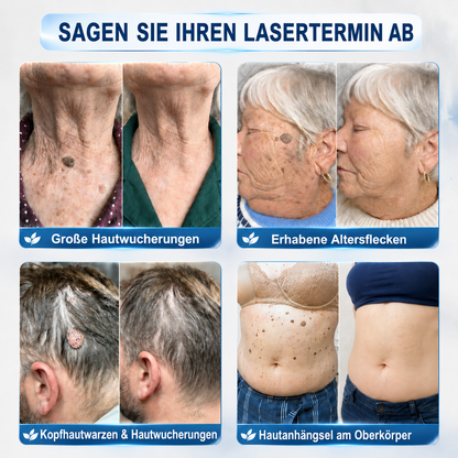 ❤️Genieße 30 % RABATT beim Hinzufügen des zweiten Produkts| ❤️ 𝐇e𝐚l𝐫i𝐳e®❤️