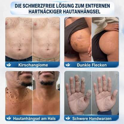 ❤️Genieße 30 % RABATT beim Hinzufügen des zweiten Produkts| ❤️ 𝐇e𝐚l𝐫i𝐳e®❤️